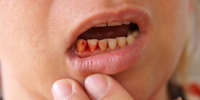 Things To Know About Dental Emergencies