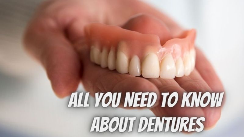 All You Need to Know About Dentures