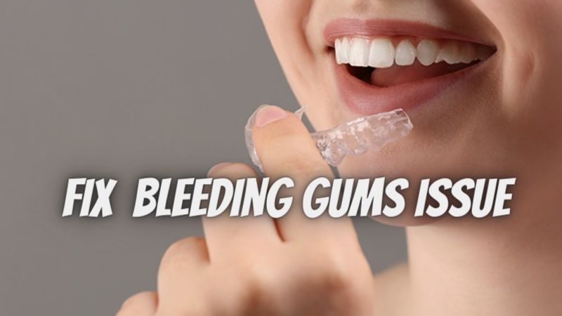 Bleeding gums? Fix the issue with a custom teeth night guard!